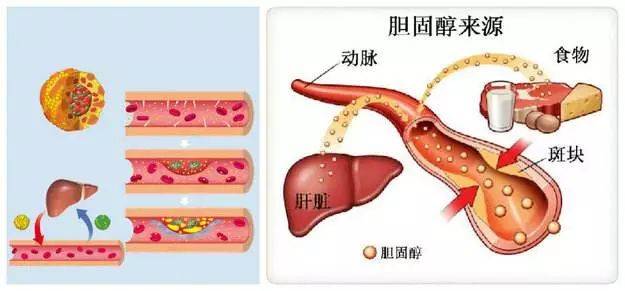 爱吃这4种食物,胆固醇会升高,中老年人一定要管住嘴!__凤凰网