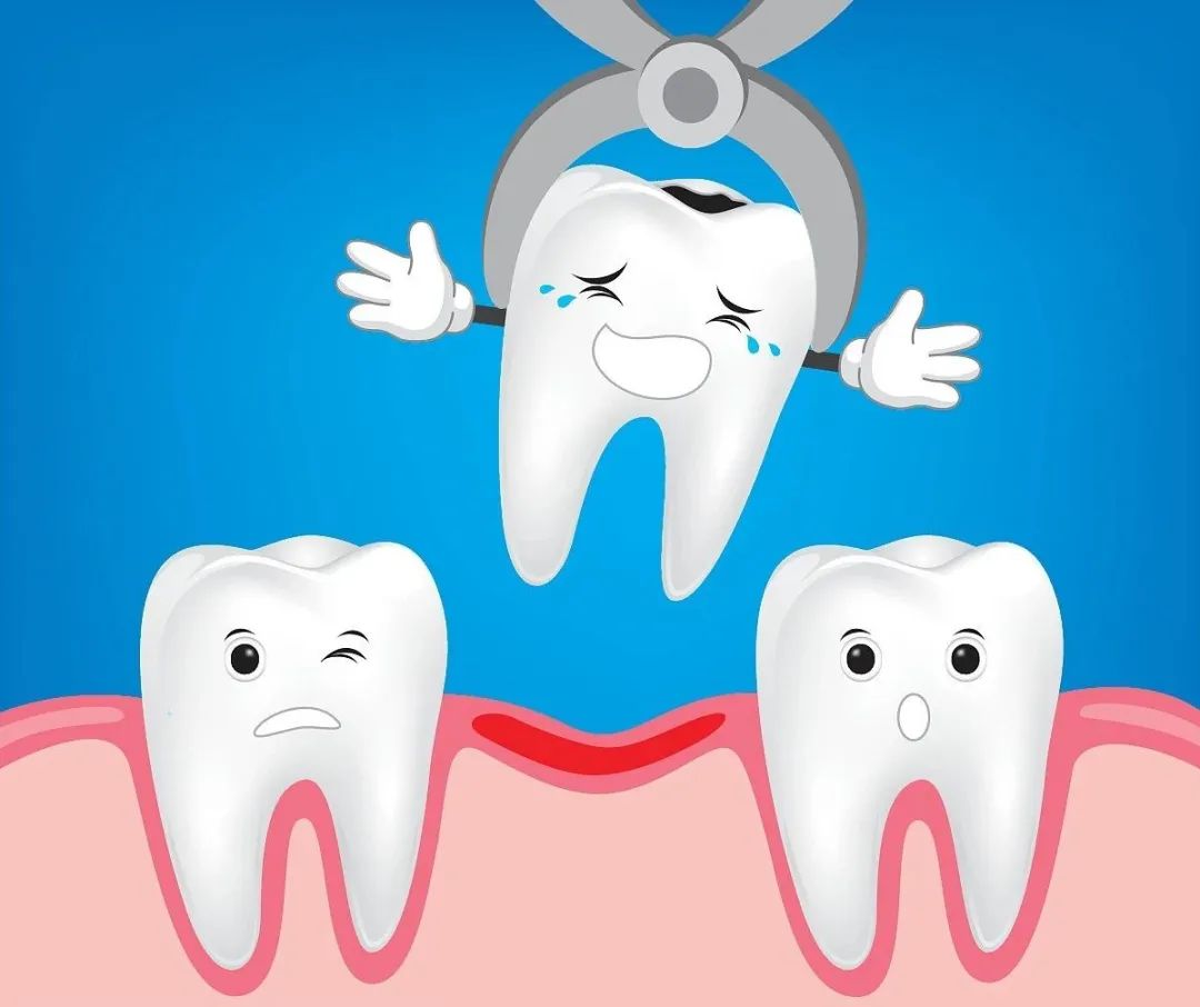 拔牙后出血的治疗与预防