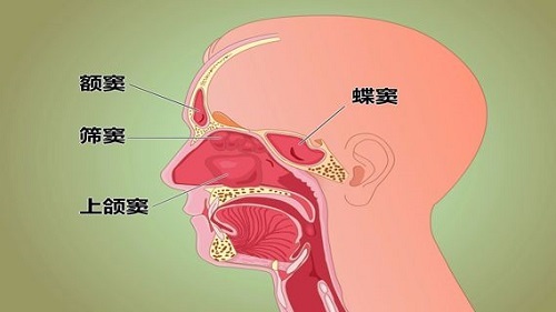 地尼,头孢丙烯,克拉霉素及罗红霉素等,还可以用中成药如鼻渊通窍颗