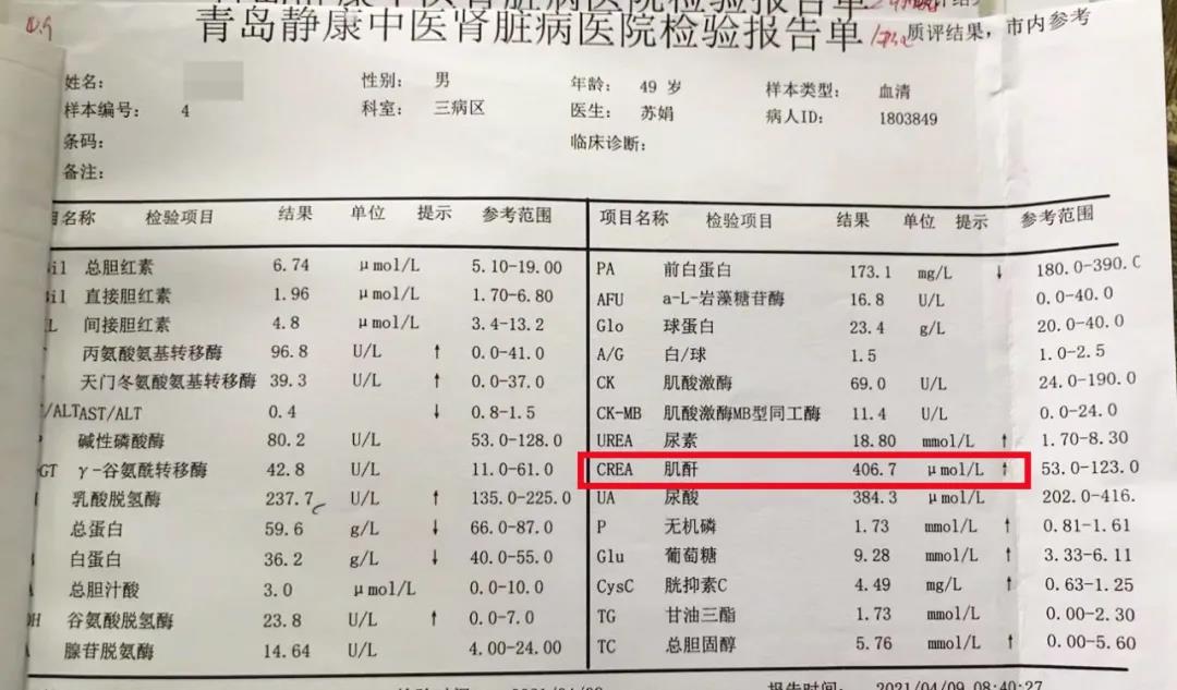 血肌酐检查图片