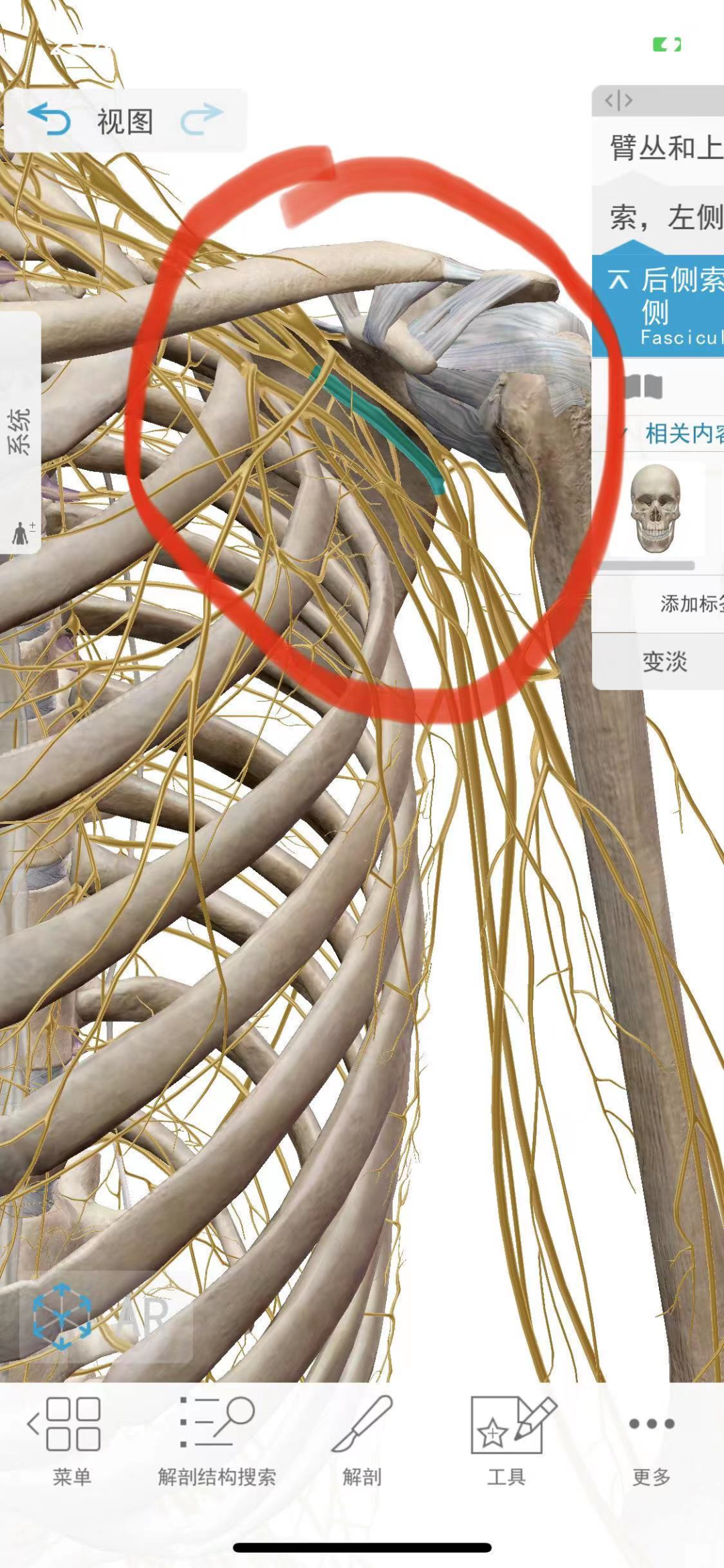 你以为的普通肩膀痛有可能是 臂丛神经炎