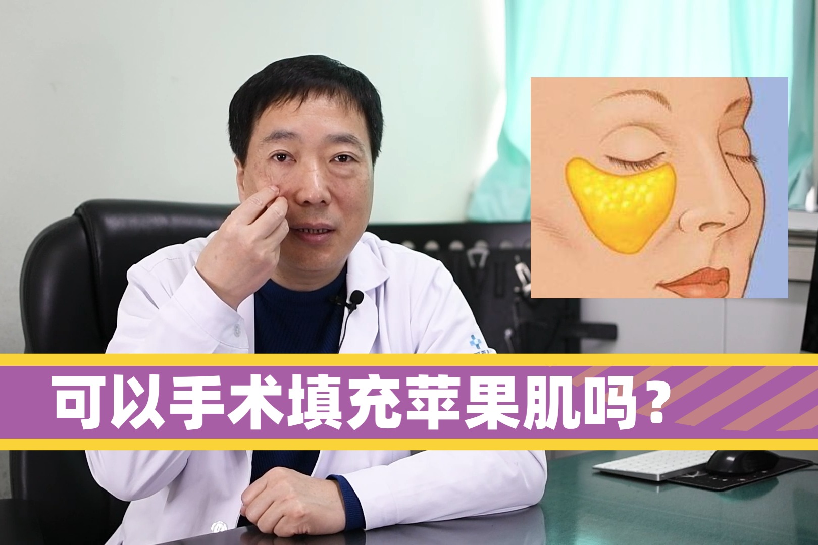 苹果肌下垂可以使用脂肪进行填充吗？整形医生为你解答