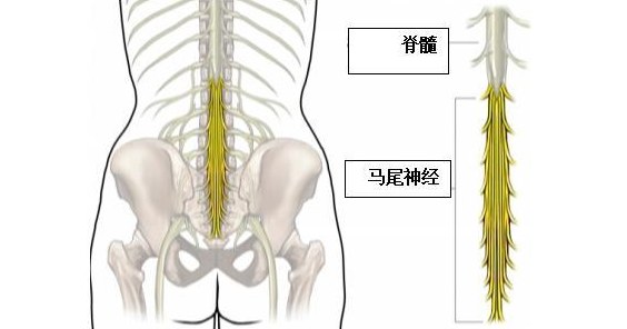 还有因为椎管内滋生囊肿或者肿瘤压迫或刺激到马尾神经