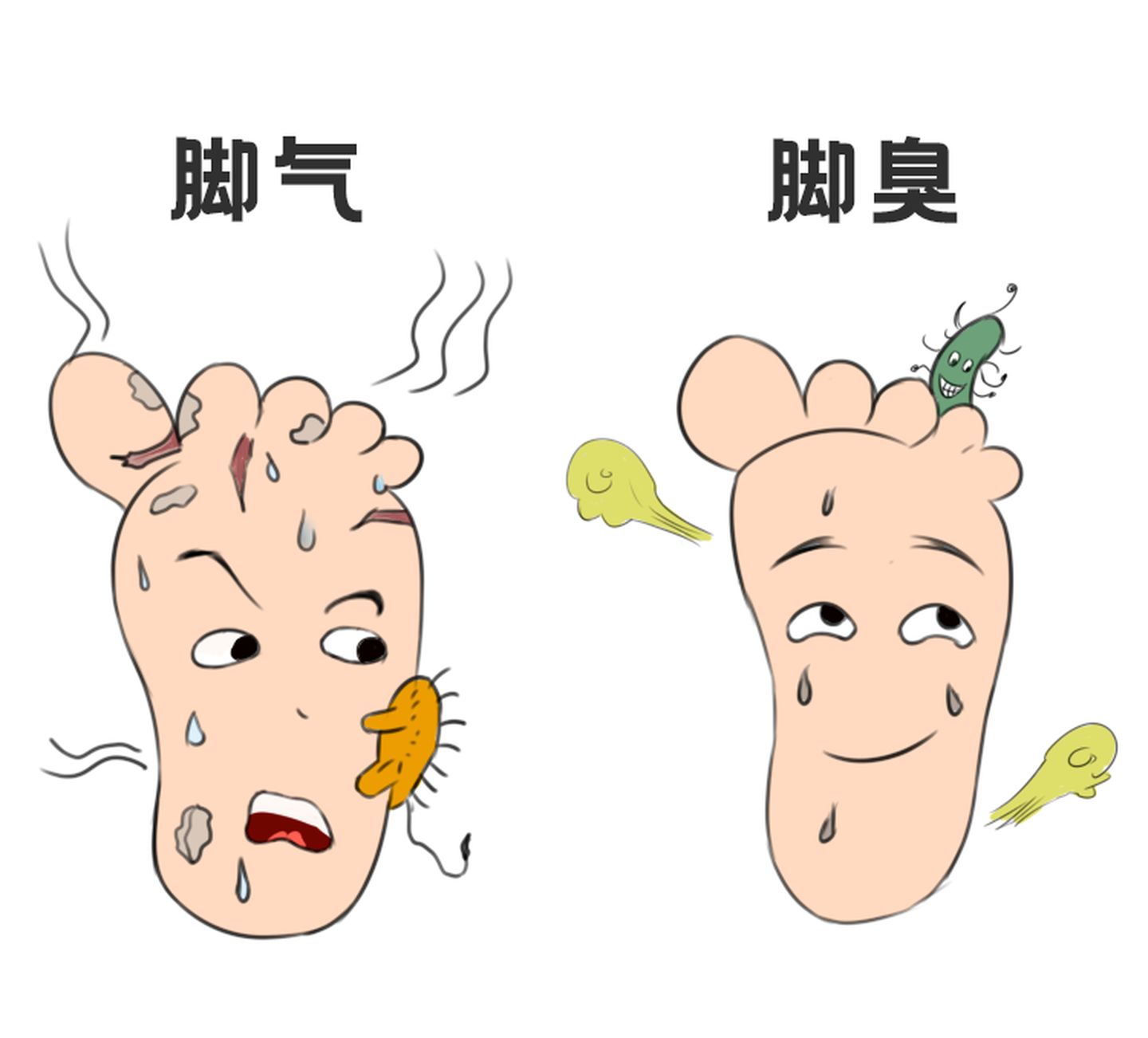 【脚气大全】脚气是什么？怎么治？怎么判别？怎么不复发？