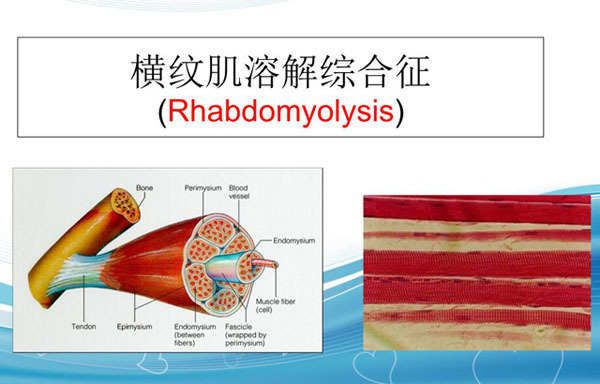 横纹肌分布图片