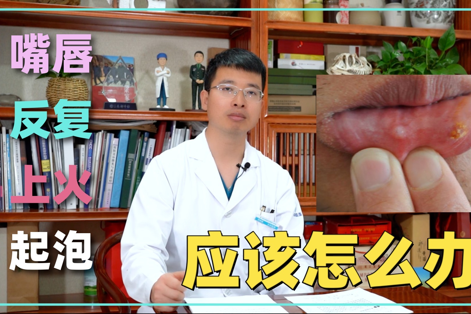 嘴破發燒… 小兒患疱疹性齒齦炎增加 | 中華日報|中華新聞雲