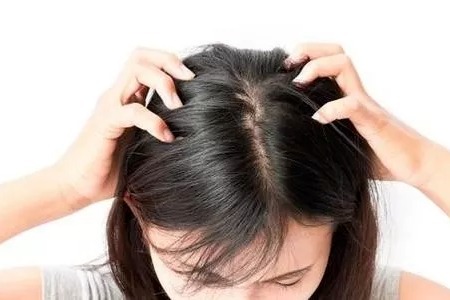 头皮发痒是没洗头所致?得了这些皮肤病,洗完头还是痒!_凤凰网