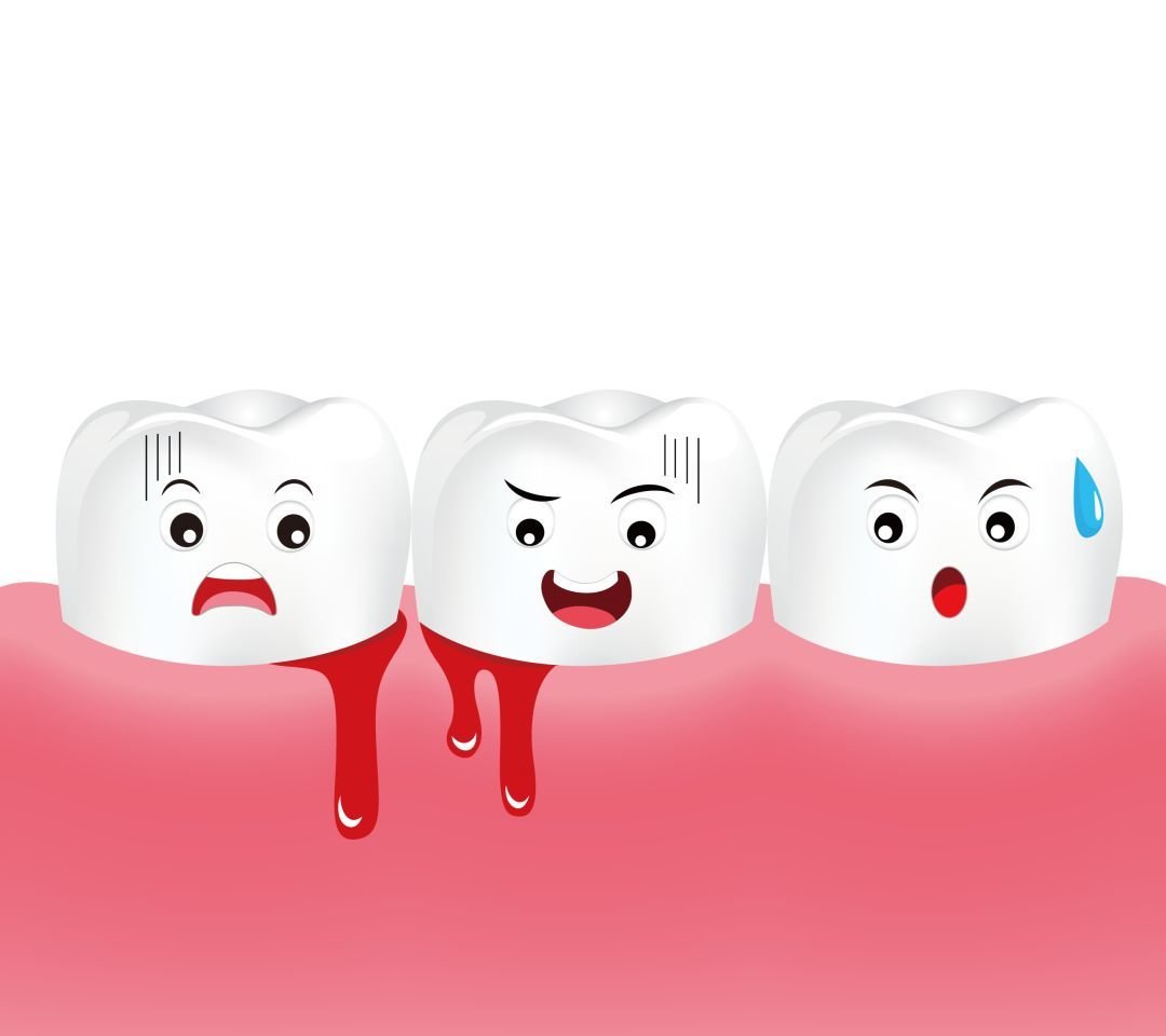 牙龈出血妨碍做种植牙吗?__凤凰网