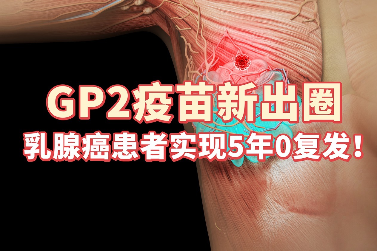 GP2疫苗新出圈，乳腺癌患者实现5年0复发！