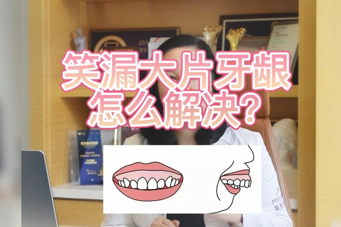 牙龈笑起来外露怎么治疗