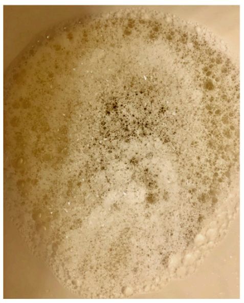 尿中为什么有泡沫,终于有了权威解释!__凤凰网