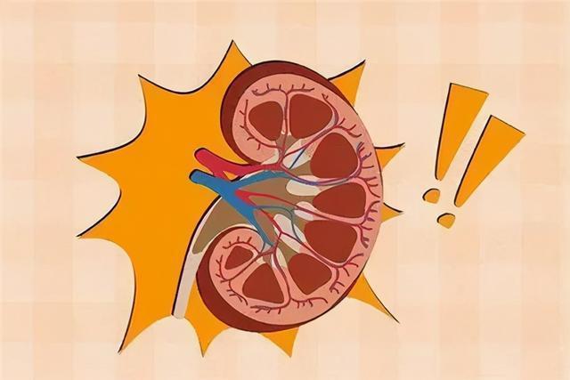 膜性肾病发生肾功能不全用中药治疗尿蛋白转阴有5个影响因素