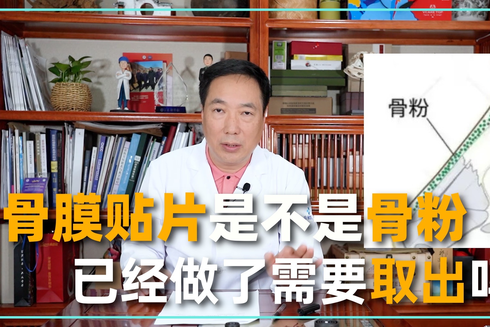 骨膜贴片究竟是不是骨粉已经使用了需要取出吗听医生说