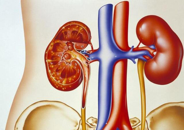 男子多囊肾8年后中医治疗稳定,多囊肾多久会肾衰?