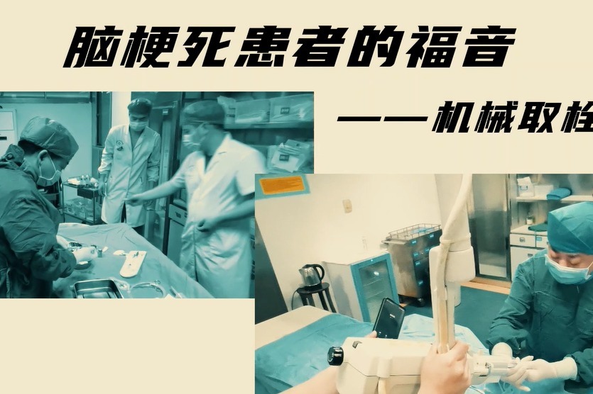 “取”之有道，完美抗“栓”丨脑梗死患者的福音——机械取栓术