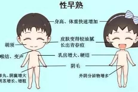 王波主任讲儿童性早熟的发育特征