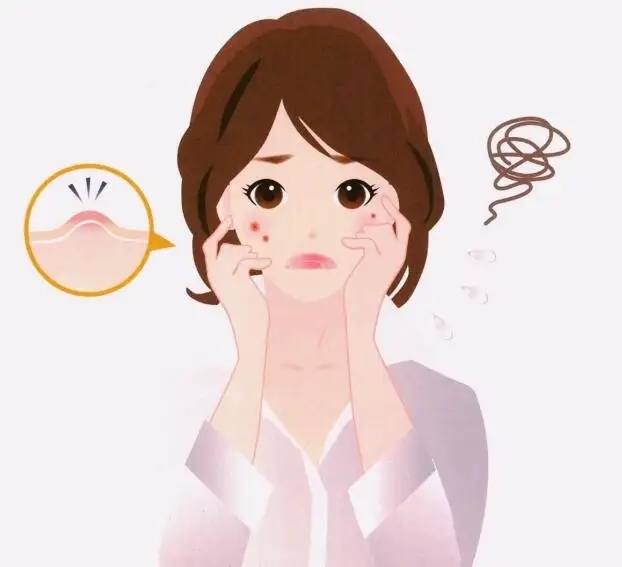 夏季祛痘4大误区你了解多少