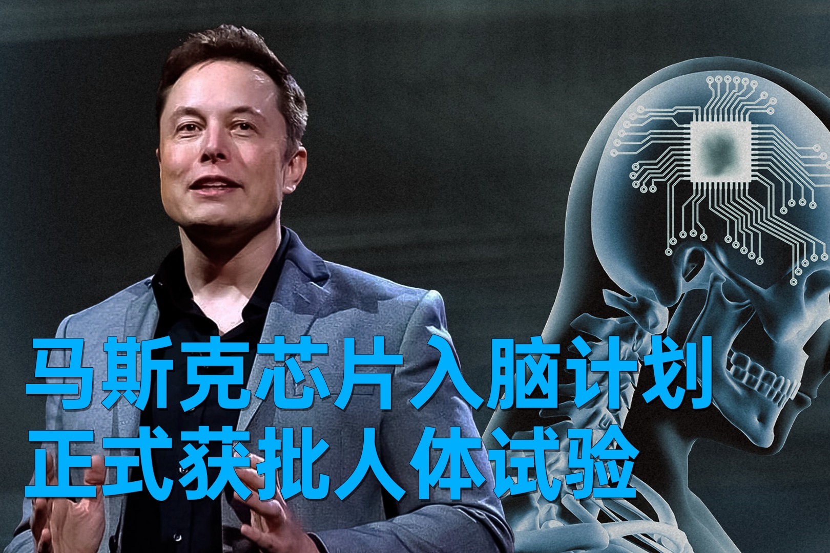 马斯克 Nerualink 芯片入脑计划，正式获得人体试验许可