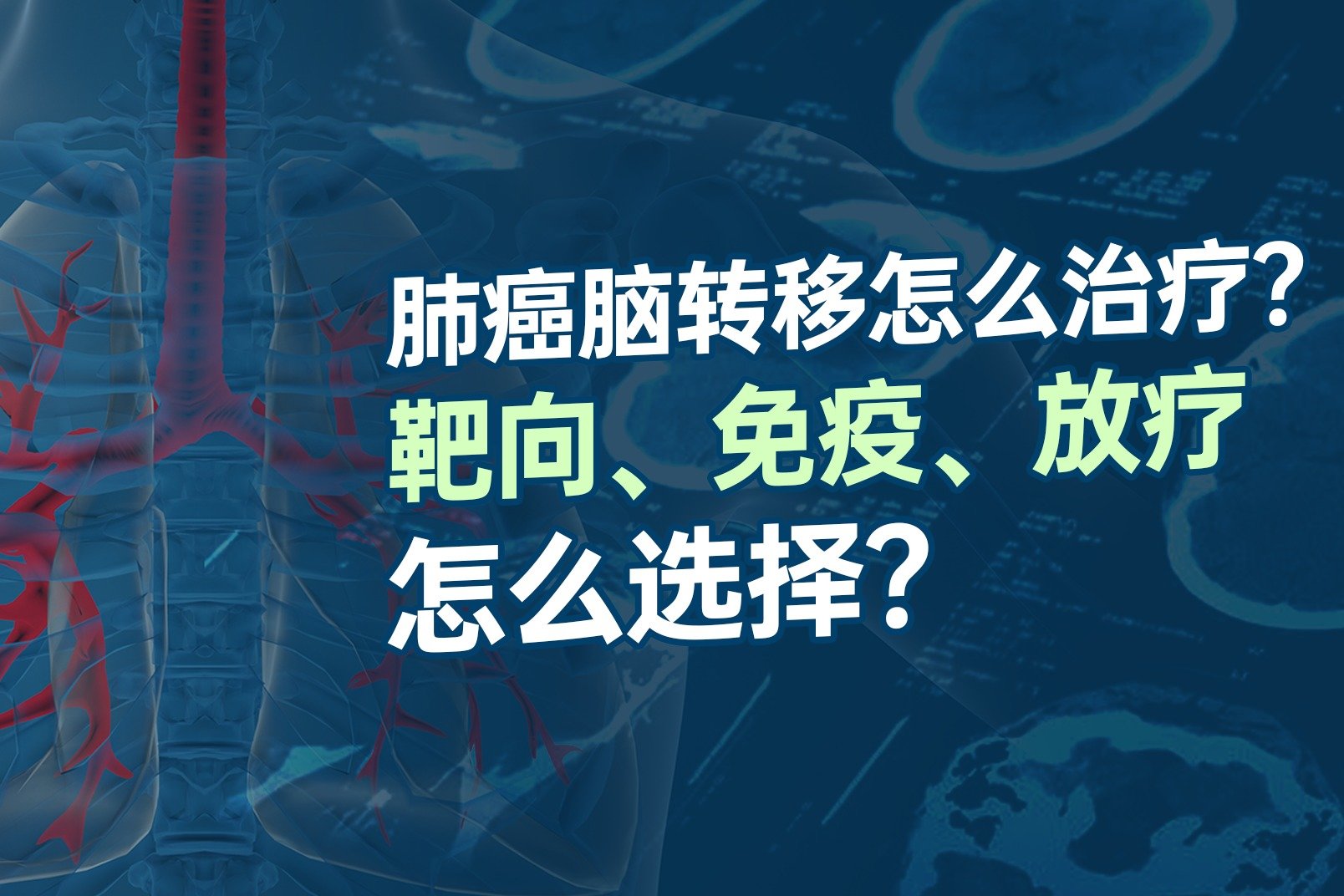 肺癌脑转移怎么治疗？靶向、免疫、放疗怎么选择？